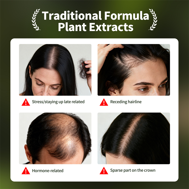 Ensemble de croissance naturel - Hair Care Natural Products avis et prix